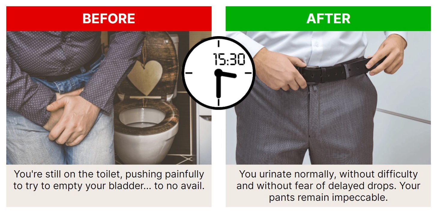 prostagen8 before and after